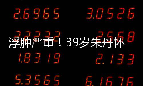 带货朱丹直播严重月 7个怀孕坚持浮肿9岁深夜